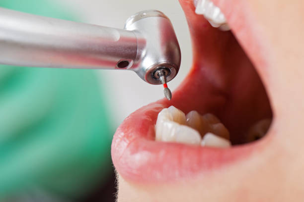 Best Emergency Tooth Extraction in Barneveld, WI